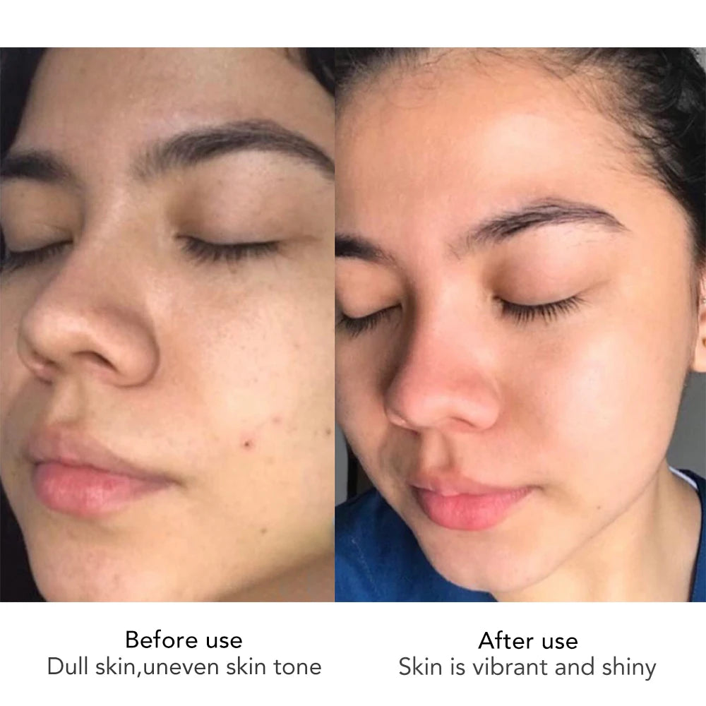 AILKE Face Cream With Hyaluron Whitening Moisturizing Care