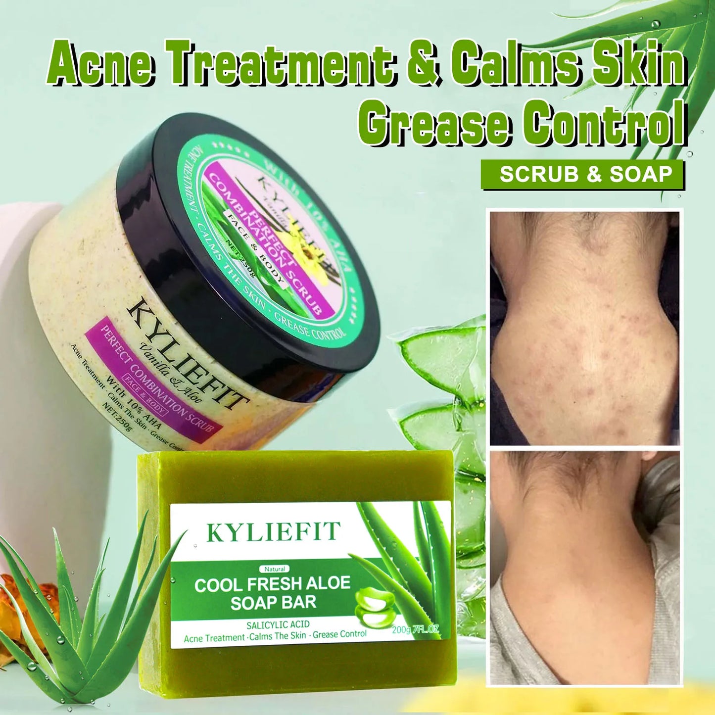 KYLIEFIT Cool Fresh Aloe Vera Soap Bar for All Skin Types, Reduce Spots, Oil Control, Deep Clean, 150g/ 7 oz